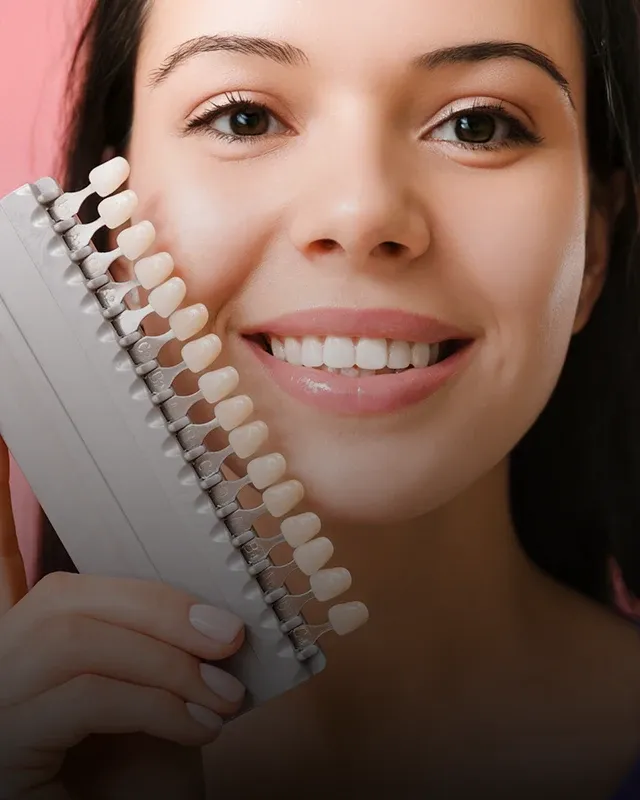 A woman holding a palette of different levels of whitening intensity up to her mouth